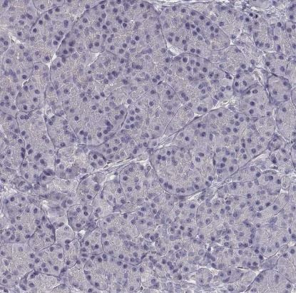 VMAT1/SLC18A1 Antibody