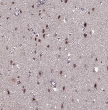 PLC-beta 4 Antibody PLC-beta 4 Antibody