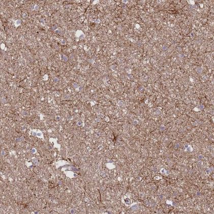 G protein alpha inhibitor 1 Antibody