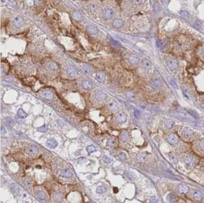 G protein alpha inhibitor 1 Antibody