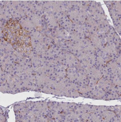 G protein alpha inhibitor 1 Antibody
