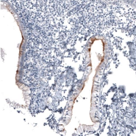 CA125/MUC16 Antibody (CL2782)