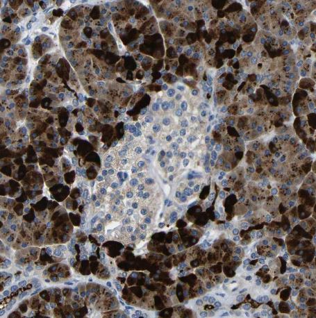 Dcp1a Antibody Dcp1a Antibody