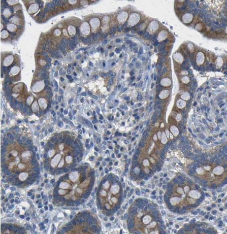 Dcp1a Antibody Dcp1a Antibody