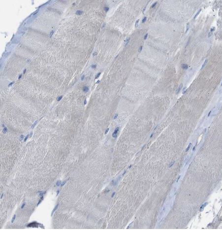 Dcp1a Antibody Dcp1a Antibody