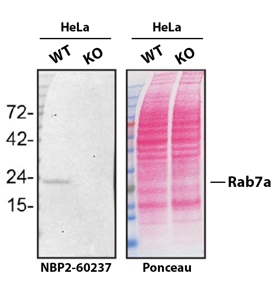 Rab7a Antibody (10E4) - BSA Free Western Blot Shows Rab7a Specificity Using Knockout Cell Line.