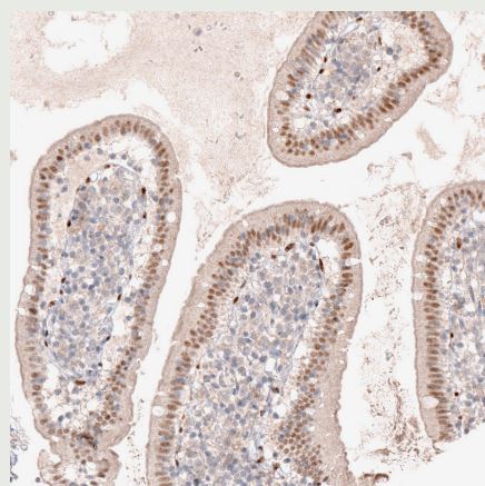 SOX6 Antibody (CL5690)