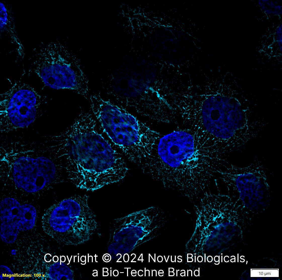 Cytokeratin 5 Antibody - BSA Free