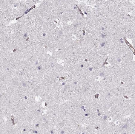 Phosphoglucomutase 5 Antibody