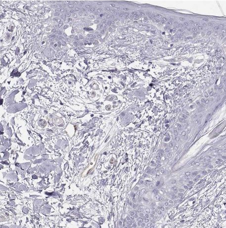 Phosphoglucomutase 5 Antibody
