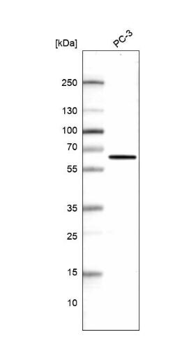 Phosphoglucomutase 5 Antibody