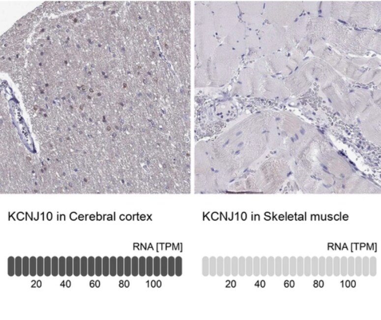 KCNJ10 Antibody - BSA Free