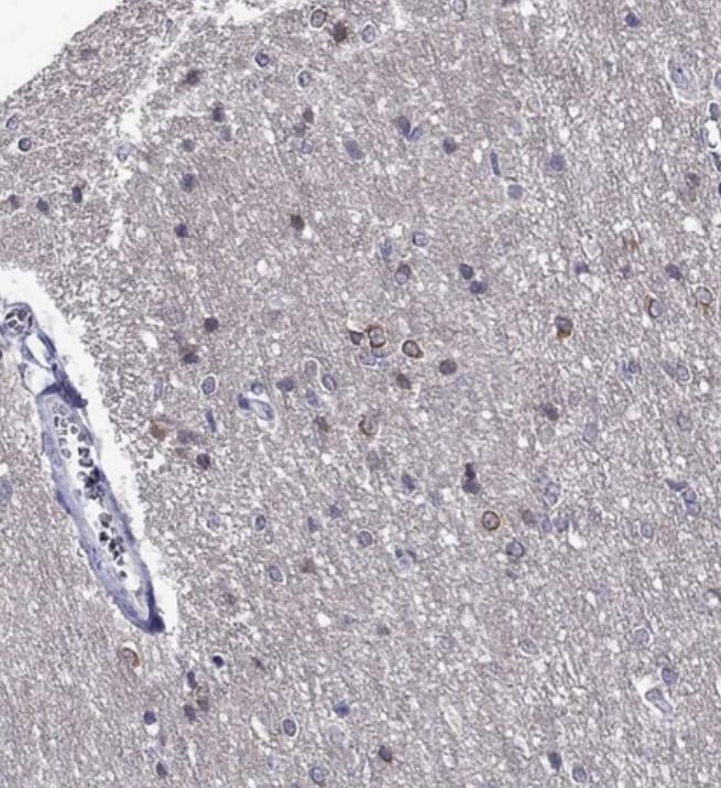 KCNJ10 Antibody - BSA Free