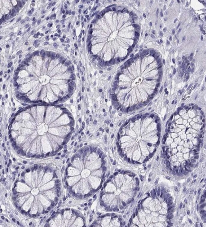 KCNJ10 Antibody - BSA Free
