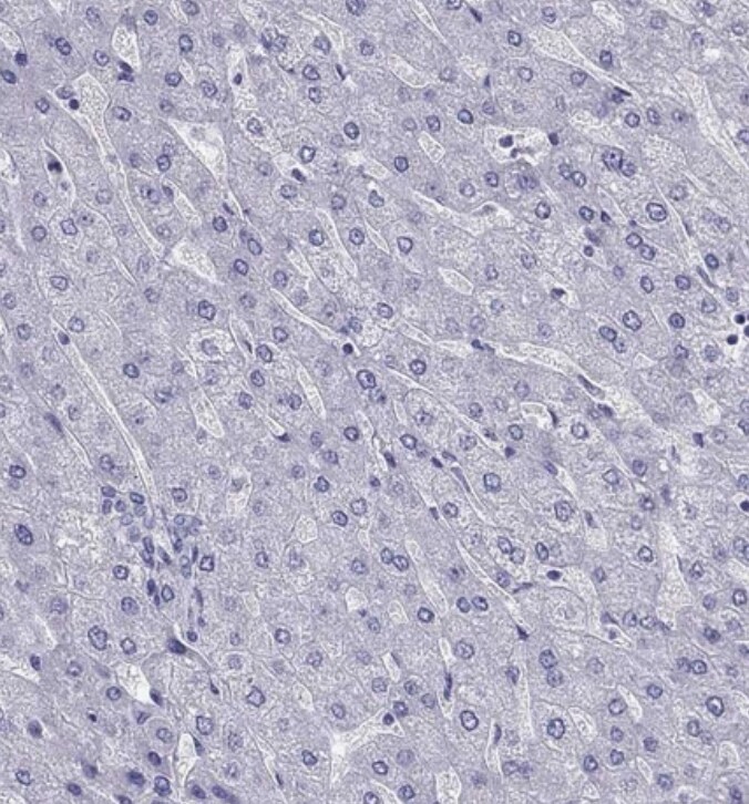 KCNJ10 Antibody - BSA Free