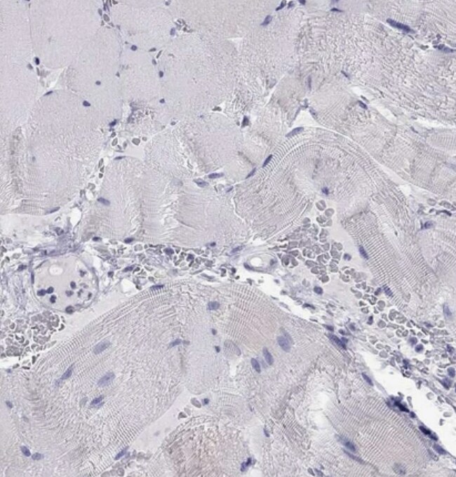 KCNJ10 Antibody - BSA Free