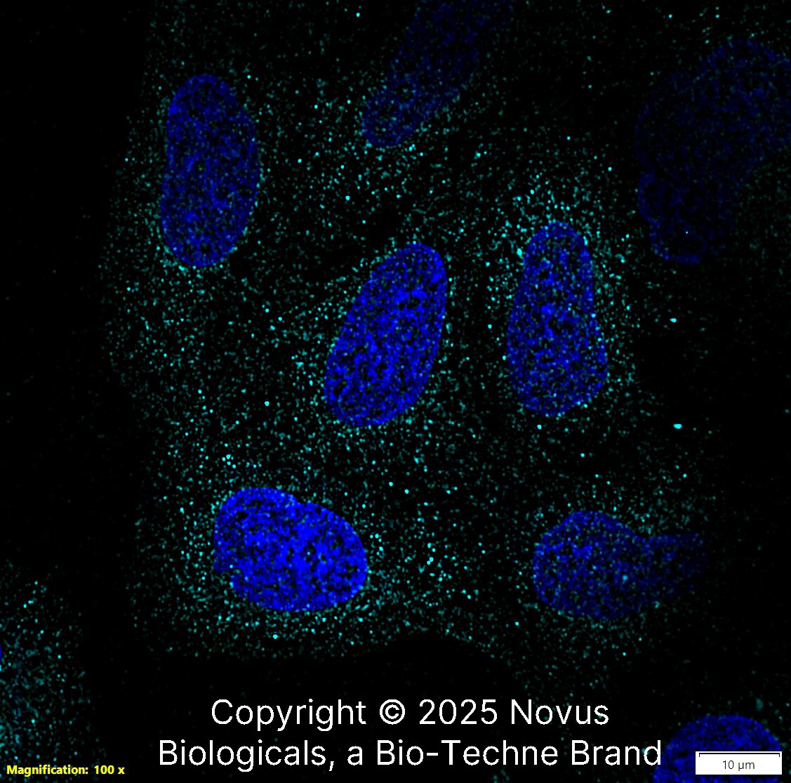 Aquaporin-5 Antibody - BSA Free