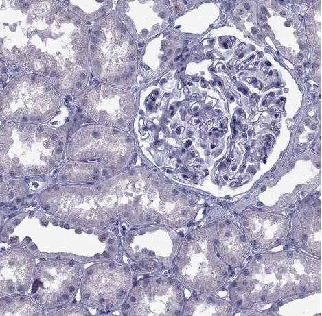 PDE6H Antibody