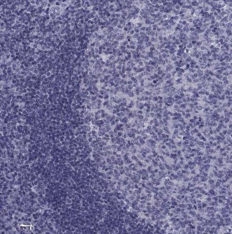 PDE6H Antibody