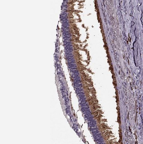 Cav1.4 Antibody Cav1.4 Antibody
