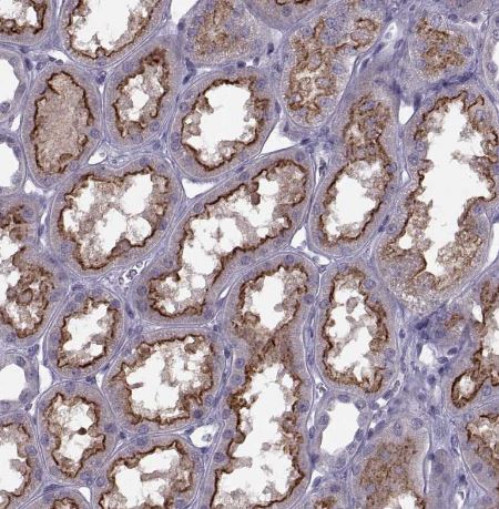 Cav1.4 Antibody Cav1.4 Antibody