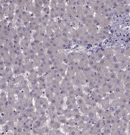 Cav1.4 Antibody Cav1.4 Antibody