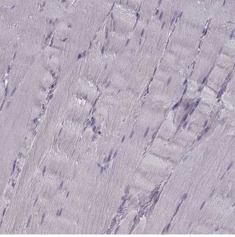 Cav1.4 Antibody Cav1.4 Antibody