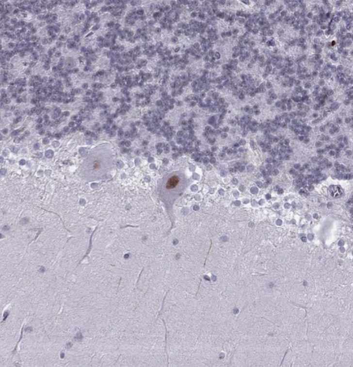 LIM1 Antibody - BSA Free
