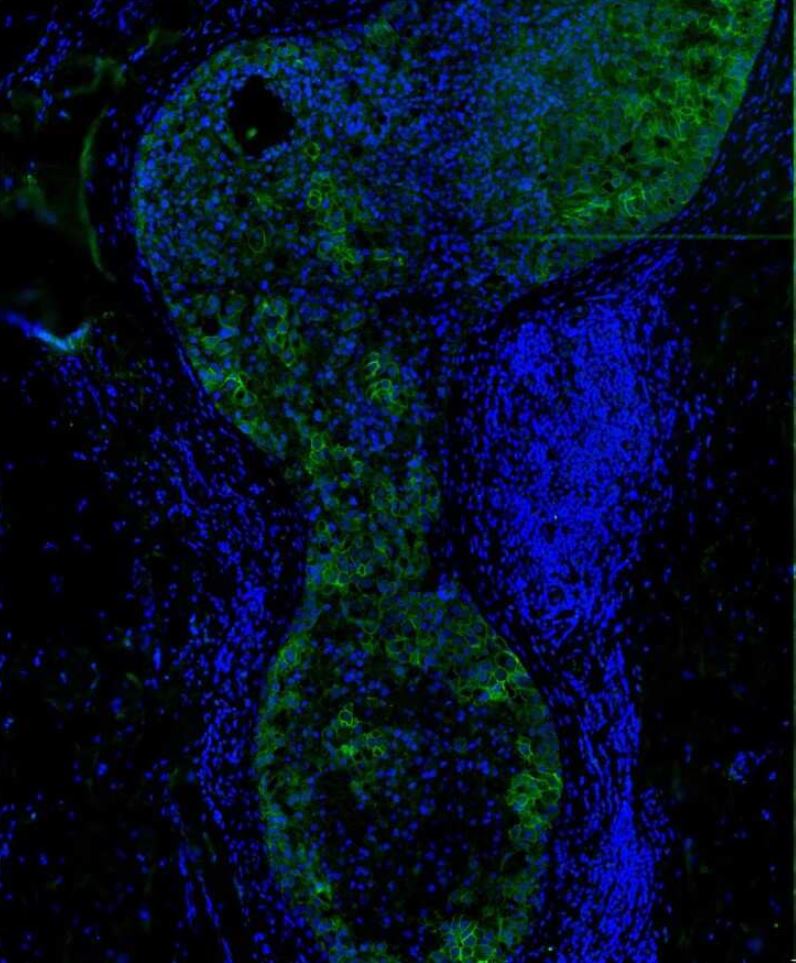 Carbonic Anhydrase XII/CA12 Antibody (OTI2C6) - Azide and BSA Free
