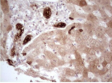PHGDH Antibody (OTI5C4) - Azide and BSA Free