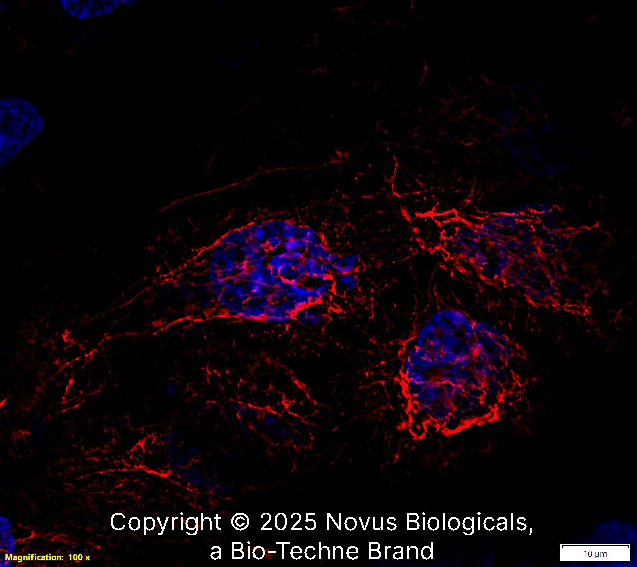 Cytokeratin 5 Antibody (CL9297) - BSA Free