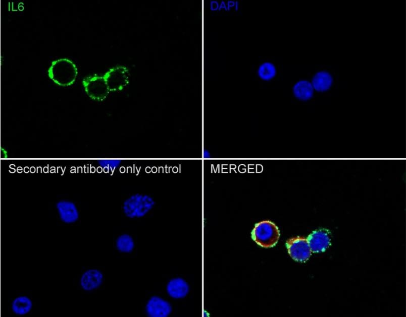 IL-6 Antibody (1-6)