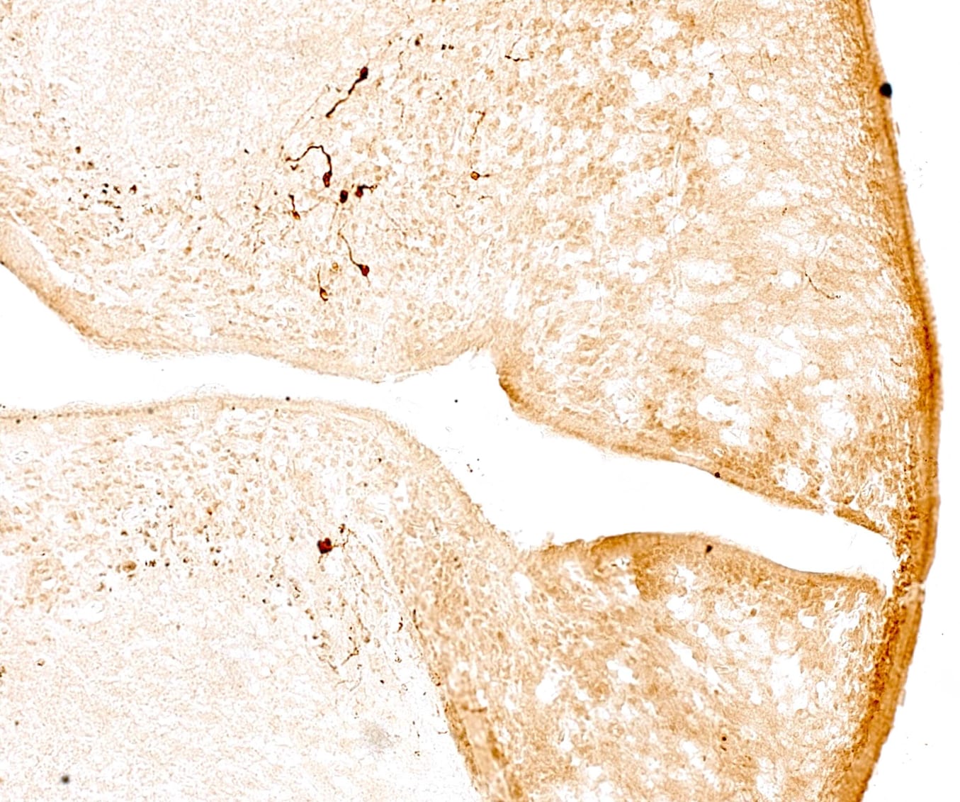PER2 Antibody