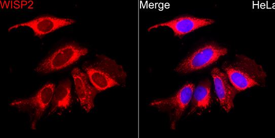 WISP2 Antibody - Azide and BSA Free