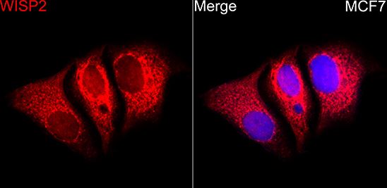 WISP2 Antibody - Azide and BSA Free