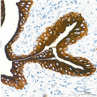 Uroplakin III Antibody - BSA Free