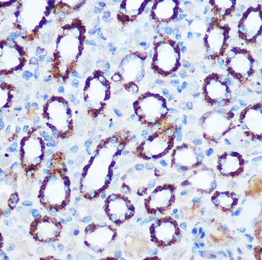 Pyruvate Dehydrogenase E1-alpha subunit Antibody - Azide and BSA Free