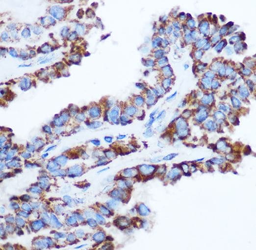 Pyruvate Dehydrogenase E1-alpha subunit Antibody - Azide and BSA Free