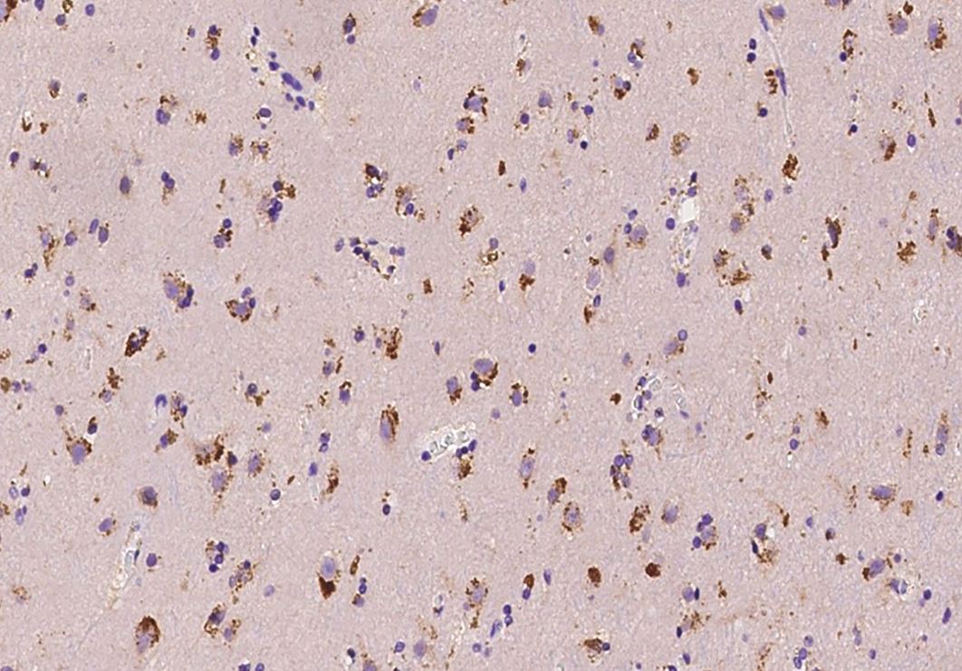 LIM Kinase 1 Antibody