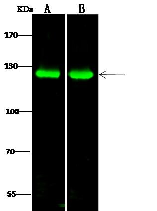 PKN1 Antibody