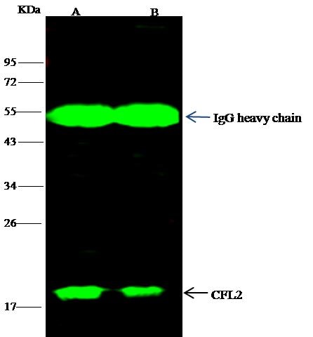 Cofilin 2 Antibody