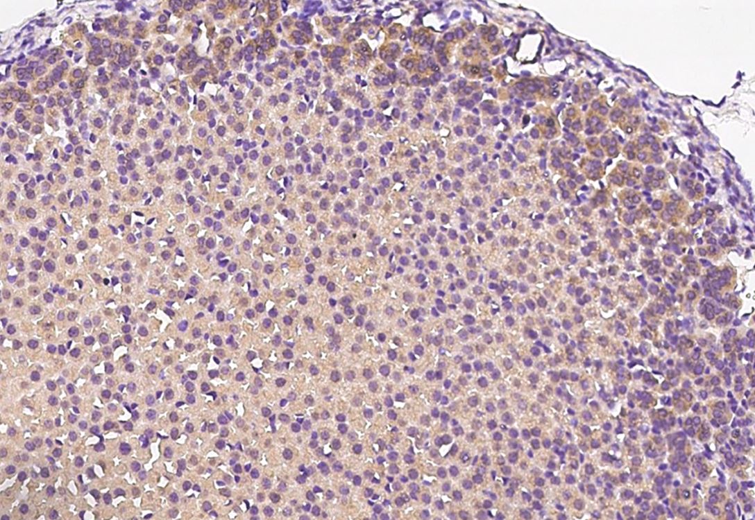 DDRGK1 Antibody