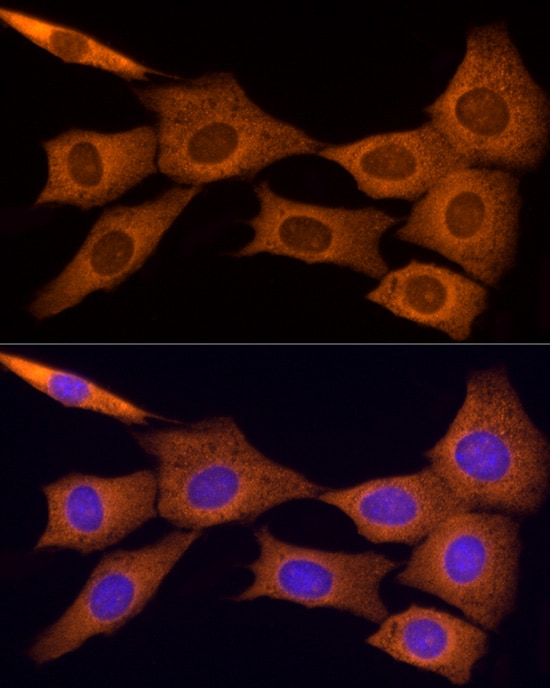 Tumstatin/COL4A3 Antibody