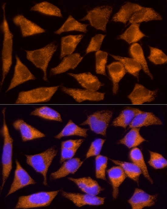 Tumstatin/COL4A3 Antibody
