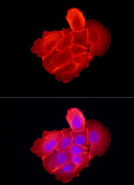 EGFR Antibody