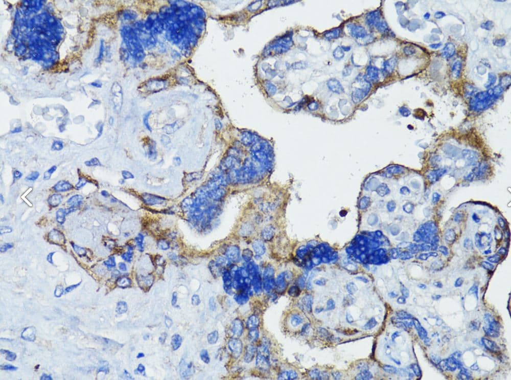 EGFR Antibody