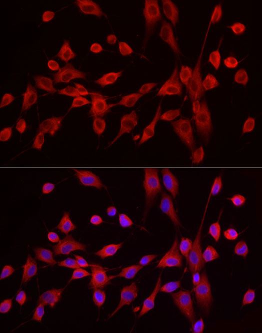 Exostosin 1 Antibody