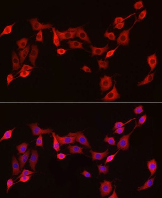 Exostosin 1 Antibody