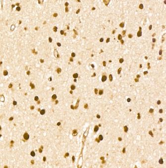THRAP3 Antibody - Azide and BSA Free