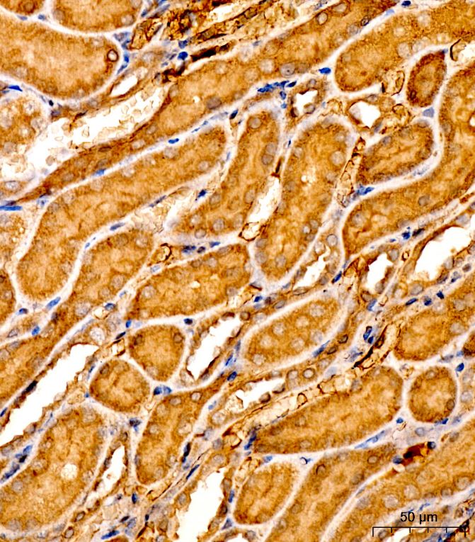 LPCAT3 Antibody - Azide and BSA Free